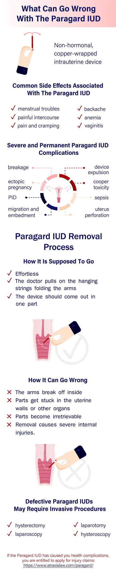 reddit paragard|paragard side effects reddit.